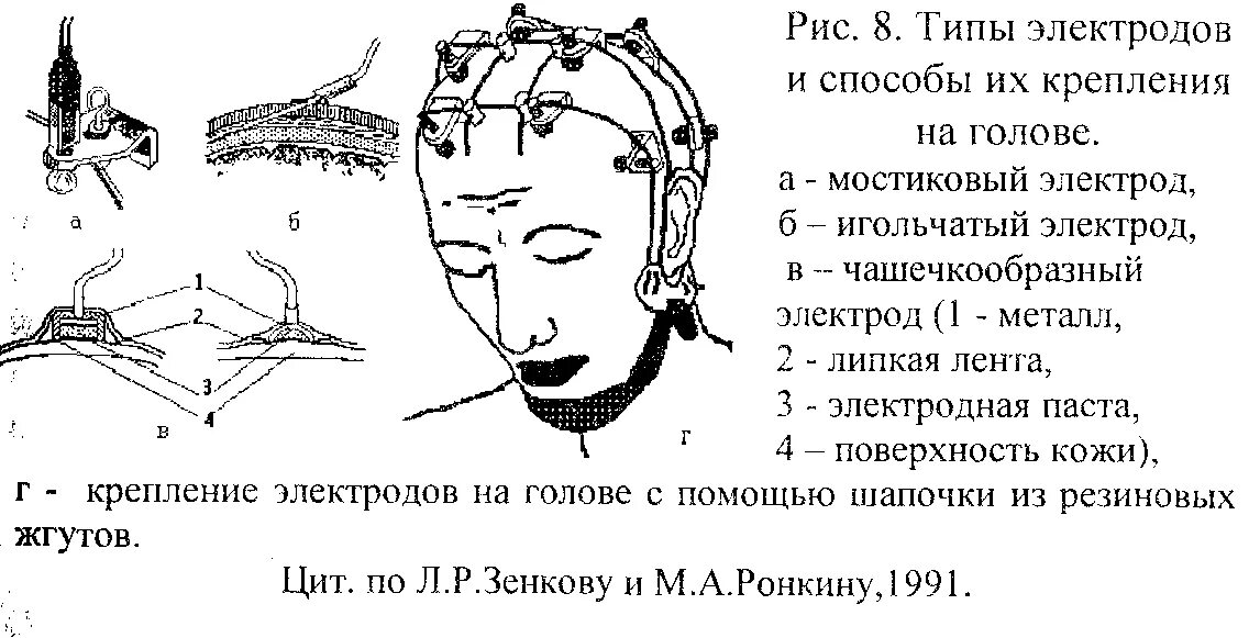 Тип постановки головы