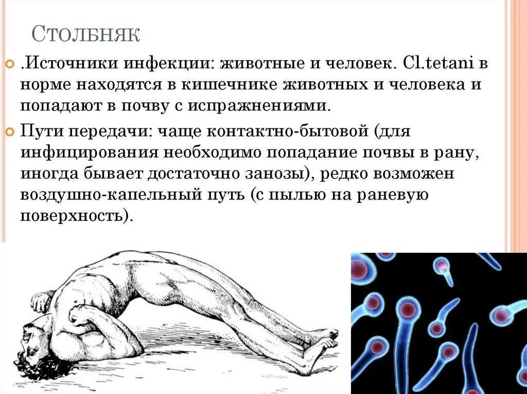 Заражение столбняком происходит. Заражение столбняком происходит. Путирередачи столбняка. Заражение столбняком происходит. Ранние проявления столбняка.