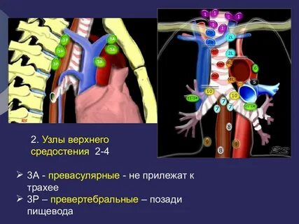 Увеличены узлы средостения