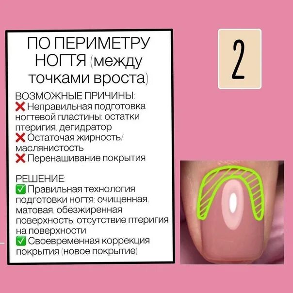 Гель не держится на ногтях причины. Причины отслоек гель лака. Причины отслоек гель лака на ногтях.