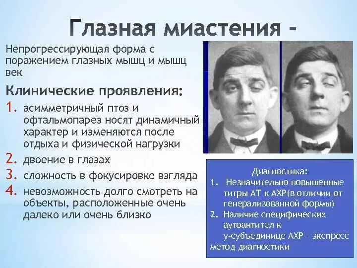 Симптомы характерные для глазной формы миастении. Глазная миастения гравис. Миастения гравис бульбарная форма. Миастения клинические синдромы. Миастения глазная форма.