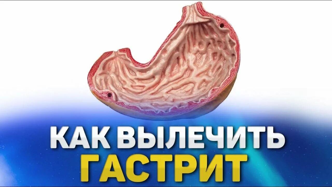 Как вылечить гастрит. Хронический гастрит излечим. Сколько лечат гастрит