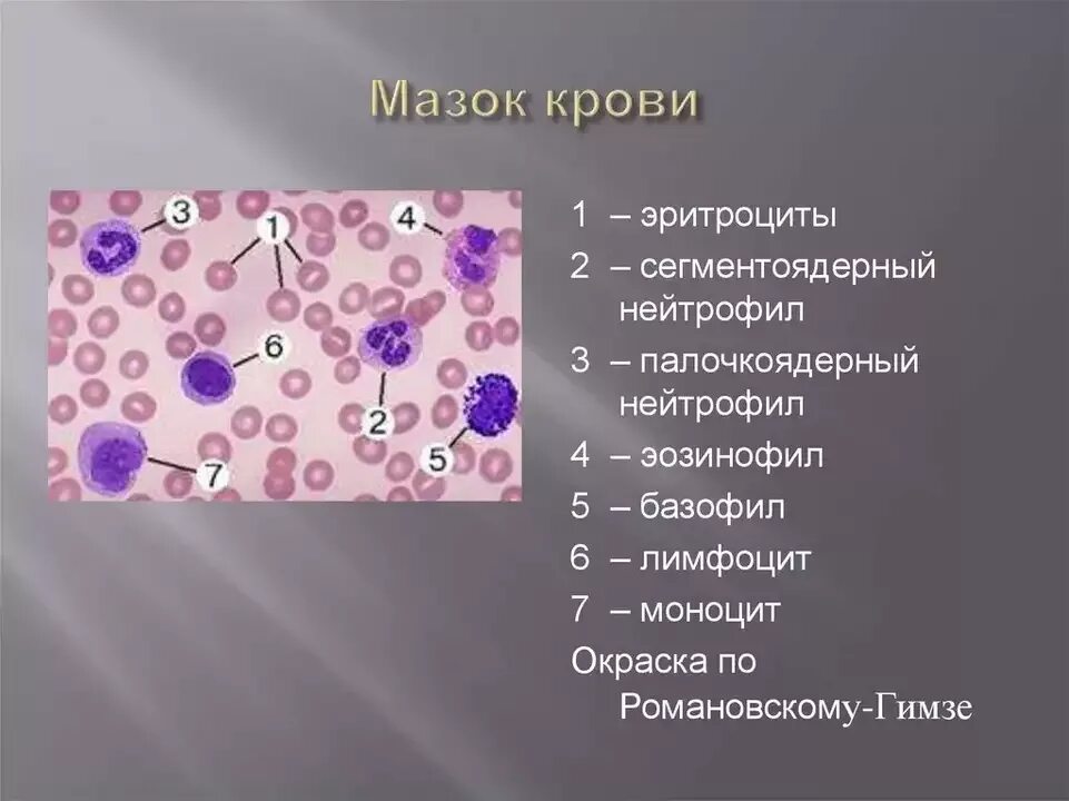 Клетки крови мазок гистология. Мазок крови : эритроцит, нейтрофил,эозинофил. Клетки крови микроскопия. Мазок периферической крови с микроскопией. Лейкоциты общие 3 3