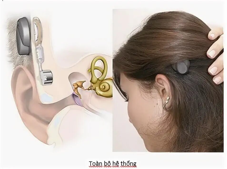 Слуховой аппарат как самому заменить слуховую трубку Слуховой аппарат,Hearing Aid купить с доставкой по выгодным ценам в интернет-м