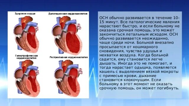 Первая помощь при острой сердечной недостаточности проект Картинки СЕРДЕЧНАЯ НЕДОСТАТОЧНОСТЬ ПЕРВАЯ МЕДИЦИНСКАЯ ПОМОЩЬ