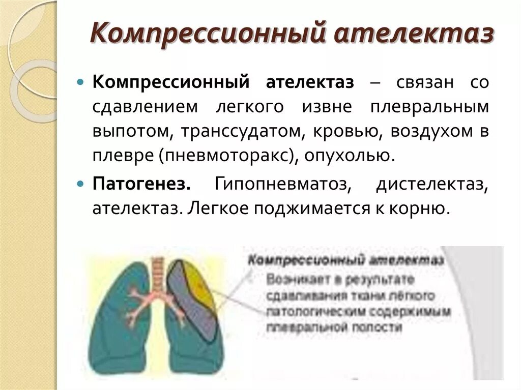 Признаки ателектаза легкого. Ателектаз механизм развития. Компрессионные ателектазы легких. Синдром компрессионного ателектаза рентген. Патогенез обтурационного ателектаза.