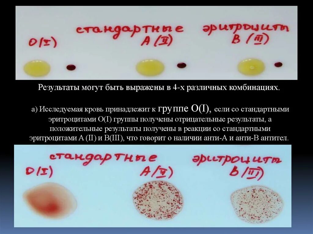 Определение группы крови. Группы крови по системе ав0. Определение группы крови по системе ав0. Группа крови стандартные эритроциты.