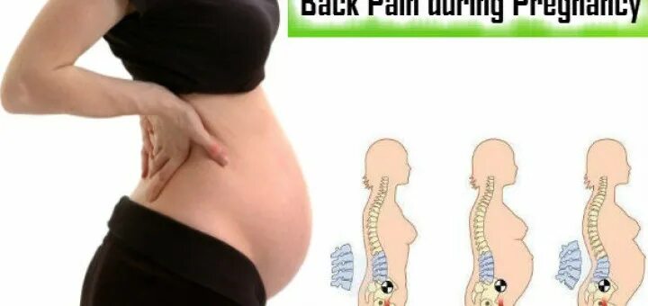 Болит поясница при беременности форум. Поясница беременной. Спина при беременности. Грыжи в пояснице и беременность. Боль в спине при беременности.