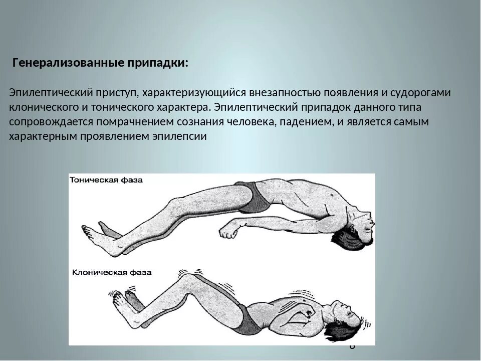 Почему есть судороги. Тонико-клонические судороги у детей. Эпилептический припадок. Клонические эпилептиформные припадки,.