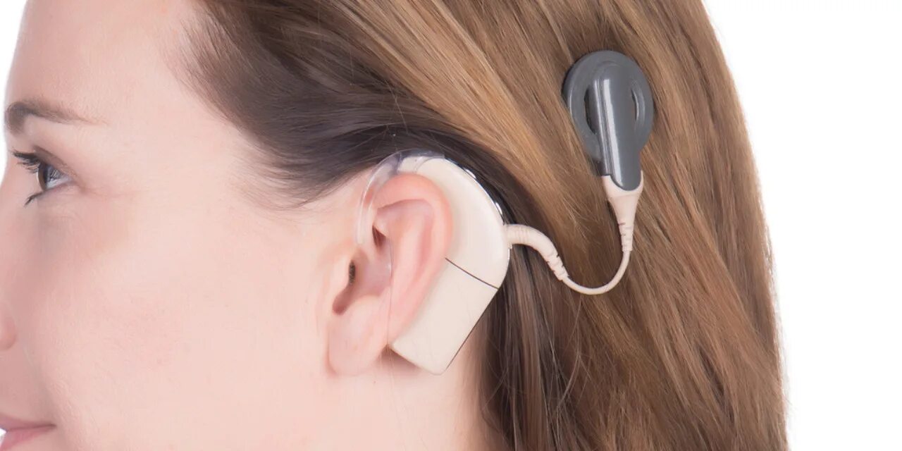 Аппарат Cochlear кохлеарный. Кохлеарный имплант кохлеар. Кохлеарный имплант слух. Отикон кохлеарный имплант. 0 hearing