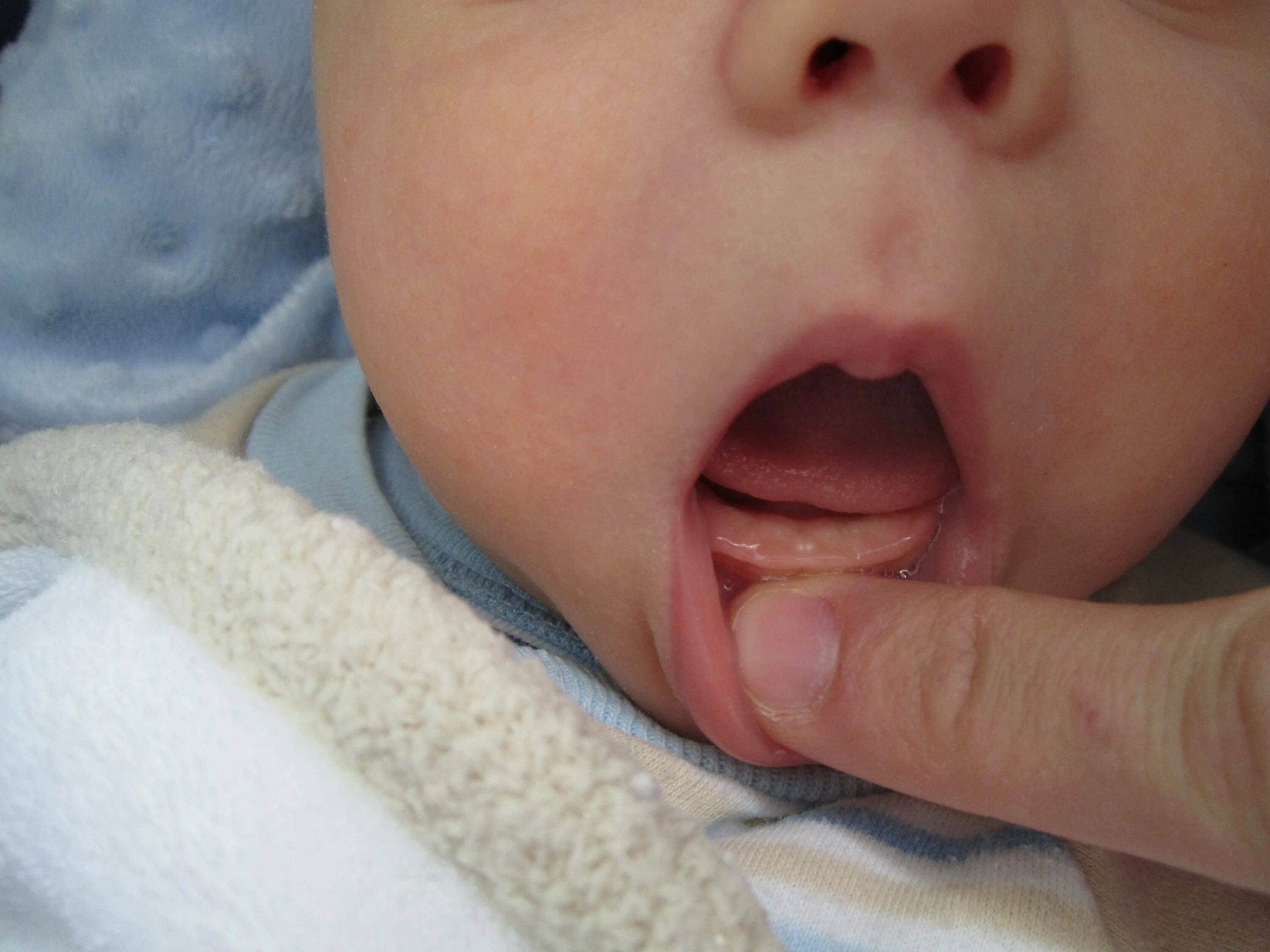 Первый зуб возраст. Прорезывание зубов у младенцев.