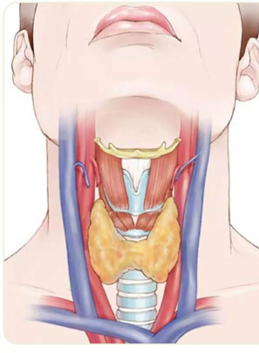 Щитовидка железа щитовидная. Зобная железа щитовидной железы. Зоб в горле
