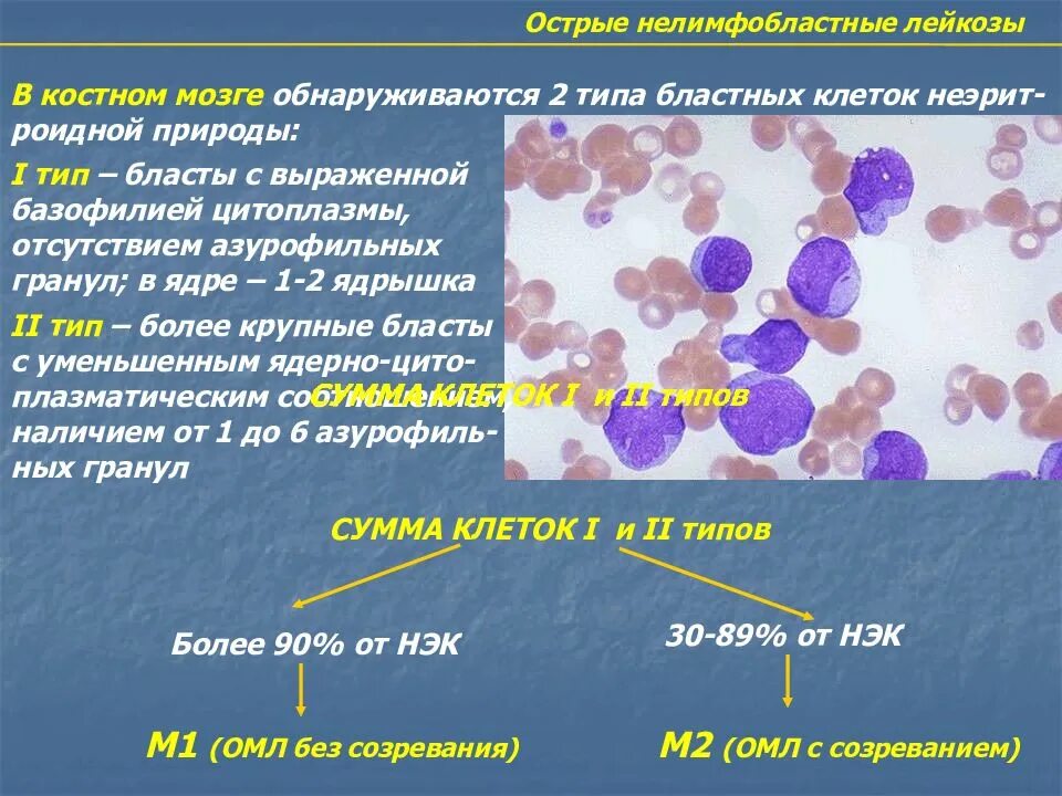 Острый лейкоз сколько живут