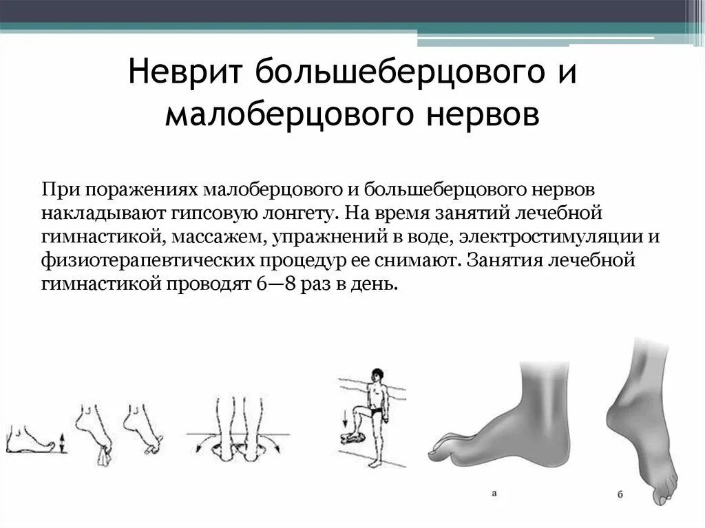 Малоберцовый нерв стопа. Нейропатия малоберцового нерва симптомы. Симптомы нейропатии малоберцового нерва. Нейропатия большеберцового нерва. Методика выявления симптомов поражения малоберцового нерва.