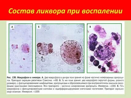 Реактивные воспалительные изменения