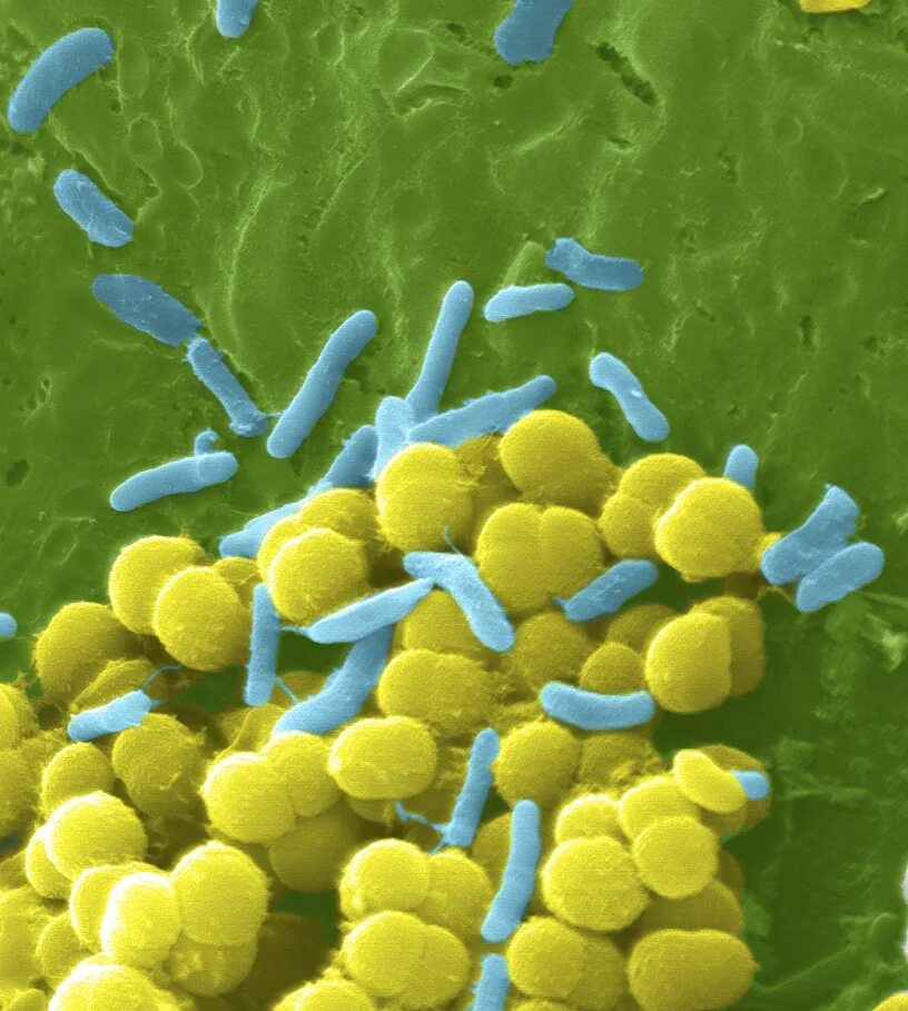 Микробы. Бактерия escherichia coli. Бактерии и антибиотики. Жизнеспособные микроорганизмы. Бактерии на марсе.