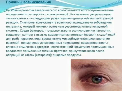 Можно ли коньюктивитом