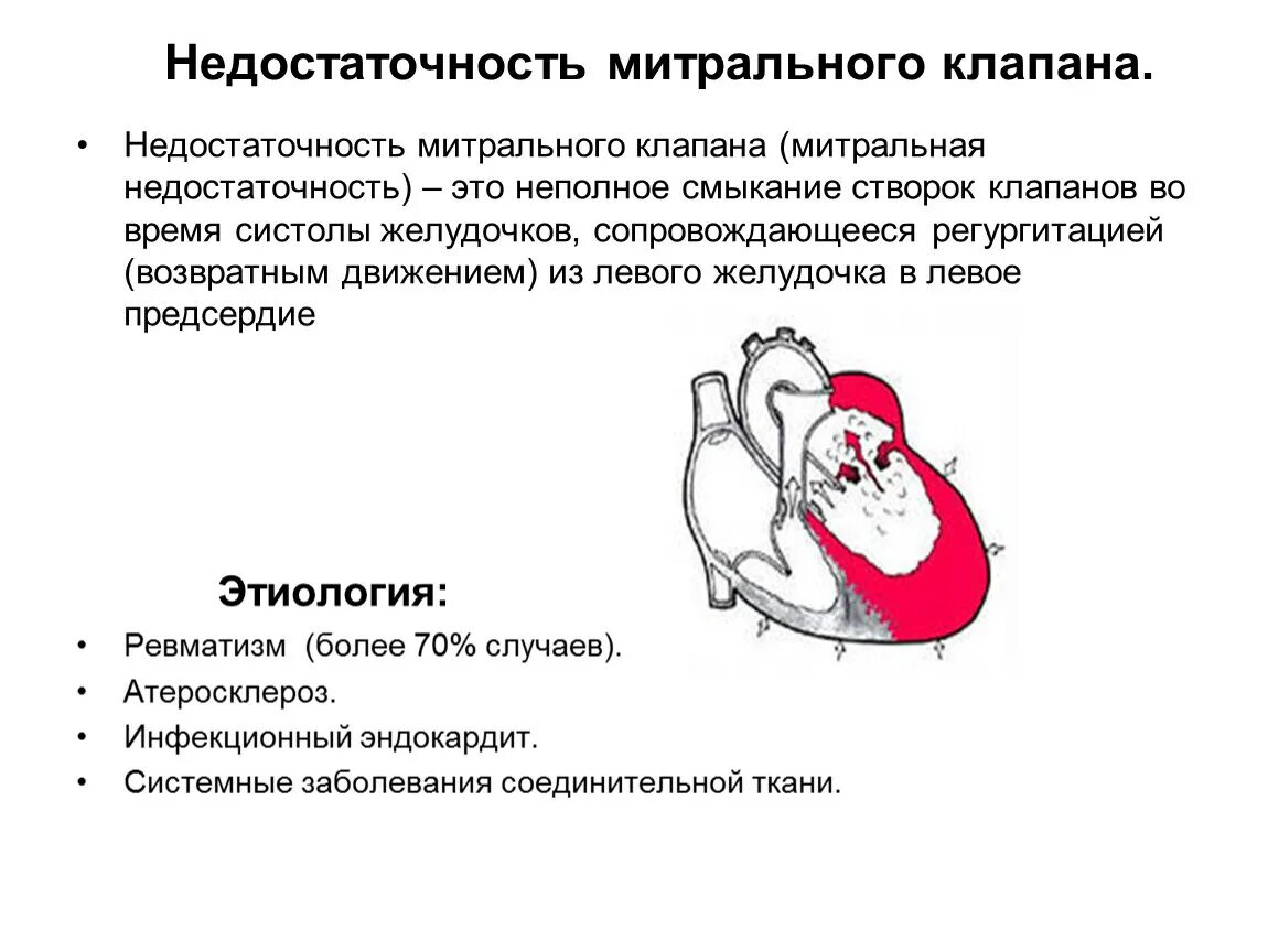 Недостаточность левого атриовентрикулярного клапана. Органическая недостаточность митрального клапана развивается при:. Функциональная митральная недостаточность. Причины развития митральной недостаточности. Сердечная недостаточность митрального клапана