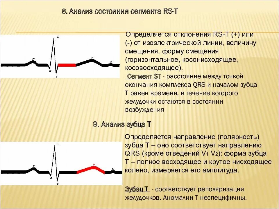 Экг для чего. Qrst на экг. схема анализа экг пропедевтика. экг комплекс qrst. схема анализа экг кратко.