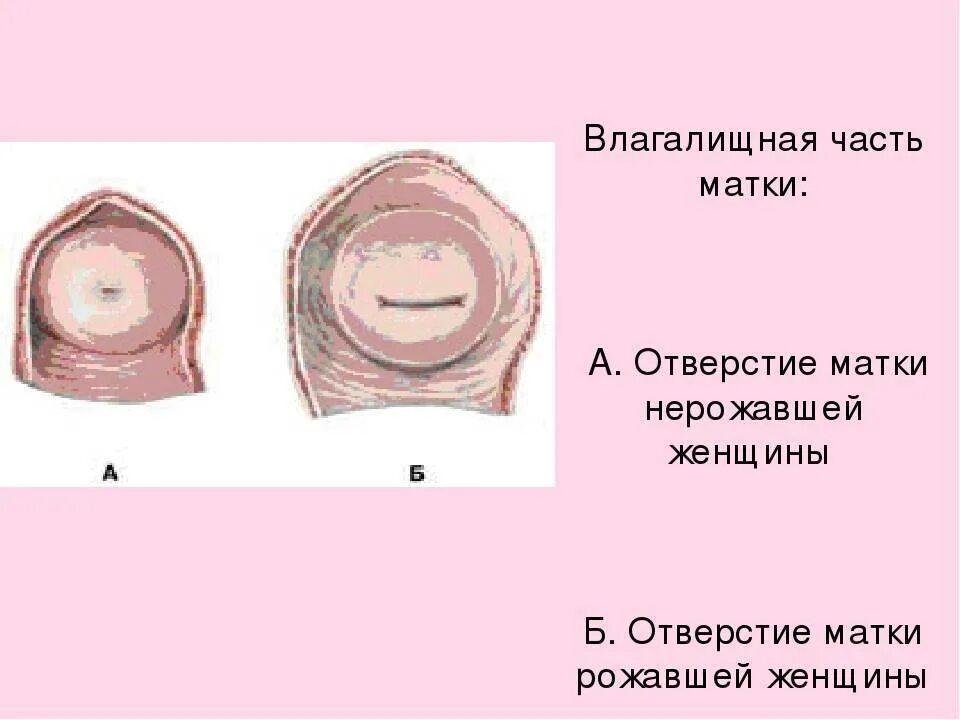 Через сколько после родов матка. Шейки матки рожавшей и нерожавшей женщины. Форма зева шейки матки. Формы шейки матки коническая и цилиндрическая. Шейка матки после родов.