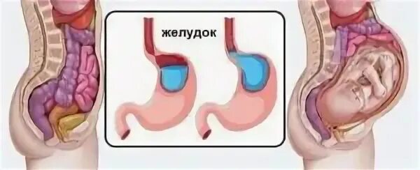 Аппендицит и беременность клинические рекомендации. Если сильно болит кишечник что это. Беременность давит на прямую кишку. Гемороль при беременности. Боль внизу живота отдаёт в прямую кишку.