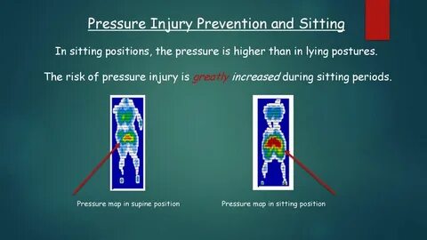 Am pressure
