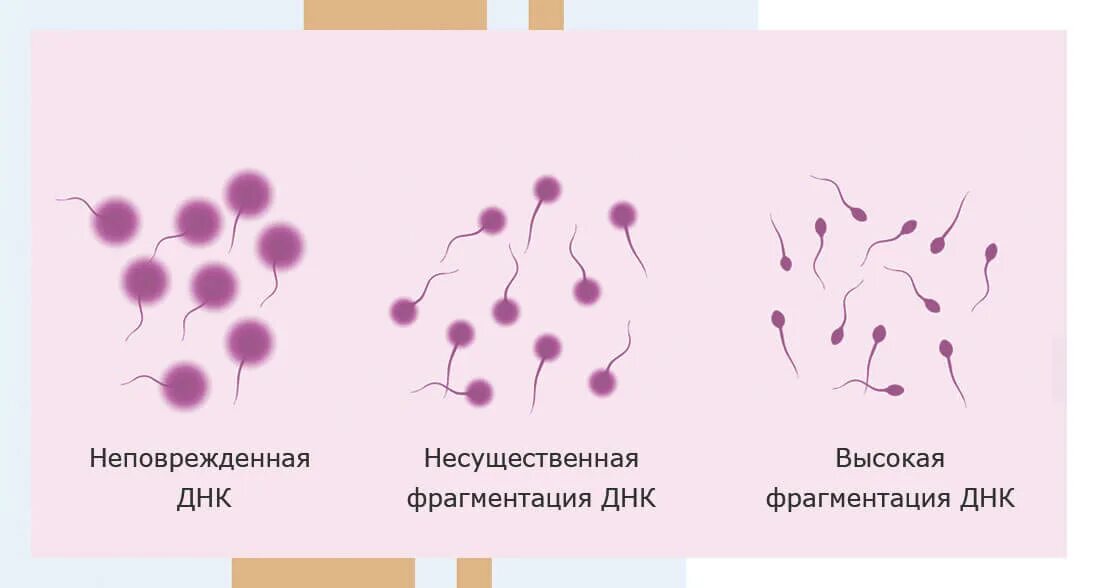 Днк спермограмма сдать. Спермограмма с днк фрагментацией. днк фрагментация методом scd. фрагментация днк сперматозоидов. методика фрагментации днк сперматозоидов.