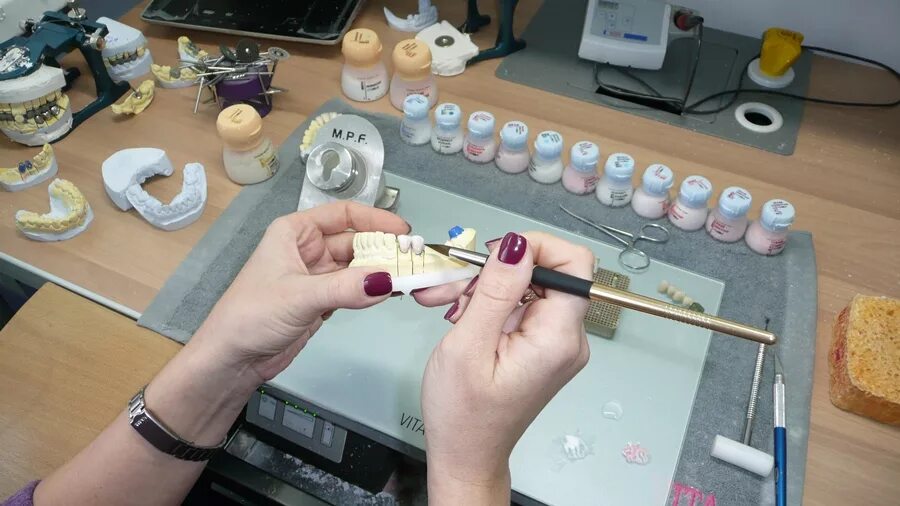 артикон зуботехническая лаборатория. гипс в стоматологии. фарфоровые зубы для съемных протезов. резьба зубов по мылу. зуботехническая лаборатория в японии.