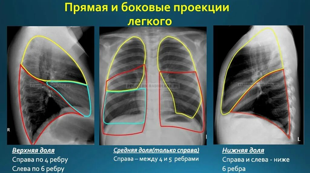 Снимок в прямой проекции
