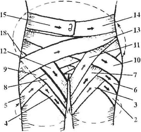 Бедренная перевязка. Колосовидная повязка на паховую область. Колосовидная повязка на тазобедренный сустав. Наложение колосовидной повязки на паховую область. Колосовидная повязка на обе паховые области.