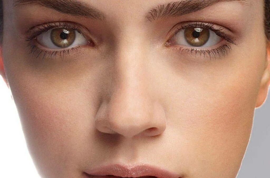 Мешки под глазами. Темные пятна под глазами. Синие круги од глазами. Чернота вокруг глаз. Темные круги од глаазми.