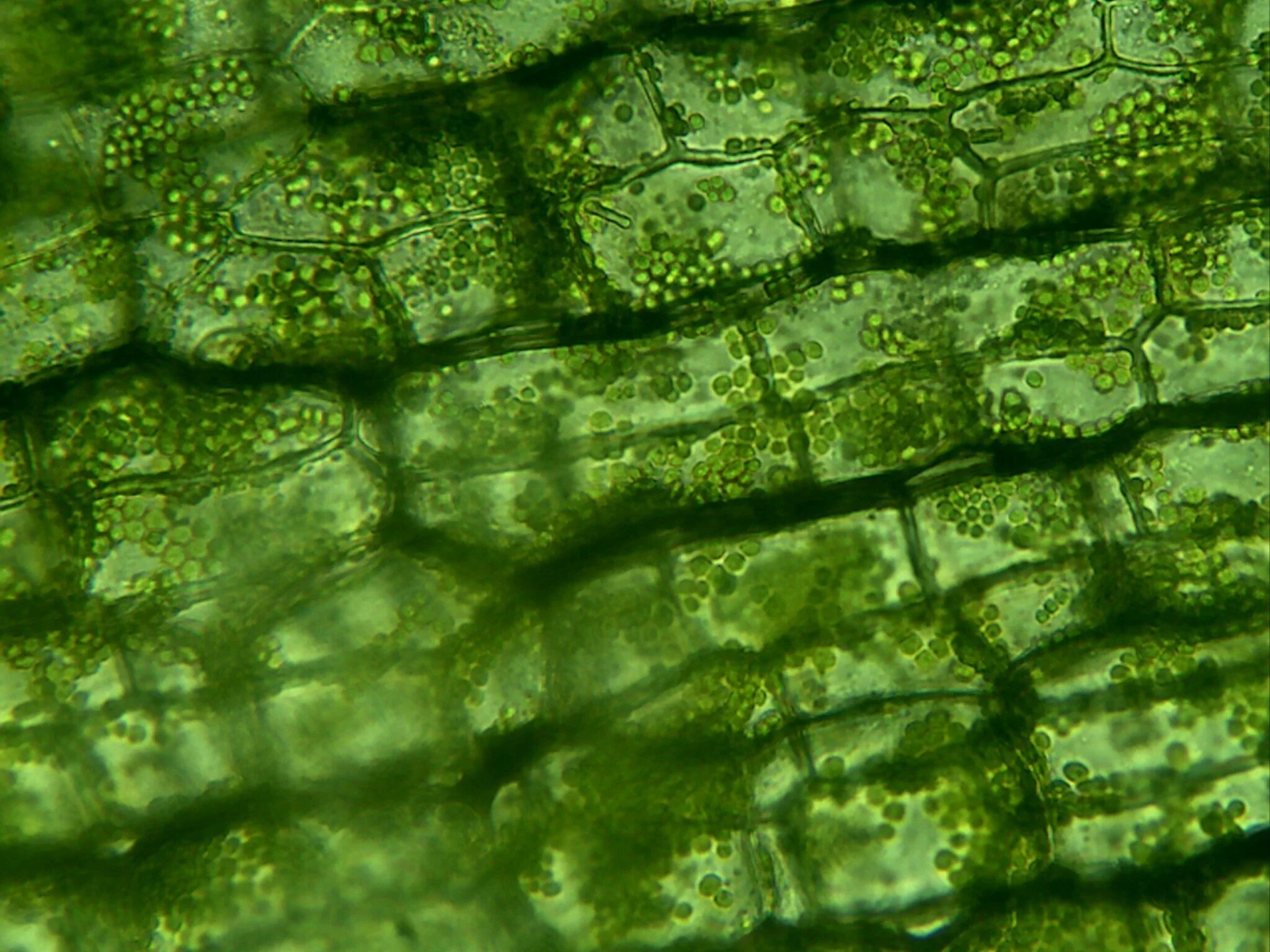 Клетки алоэ. Хлоропласты элодеи. Лист элодеи под микроскопом. Устьица элодеи. Клетки листа элодеи под микроскопом.