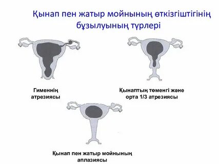 Топсыз үлкен өлшемді әйелдер