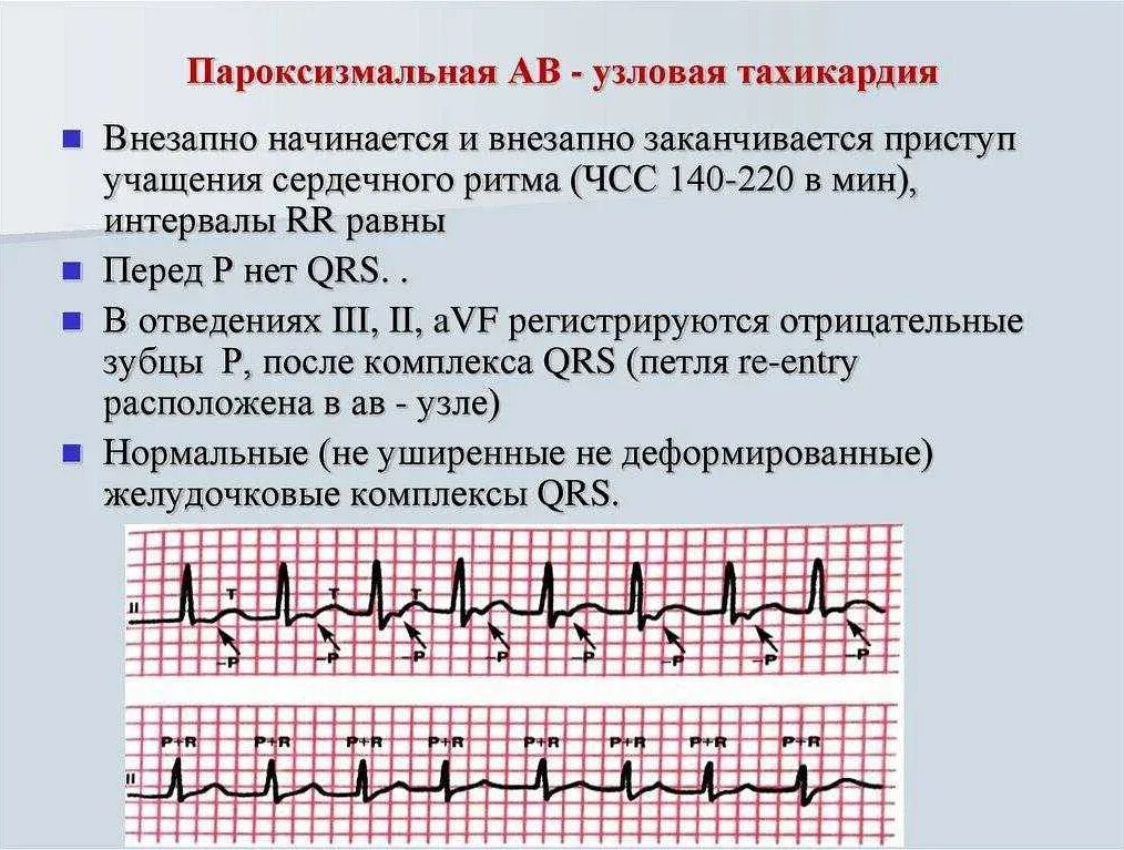 Пароксизмальная тахикардия жалобы. Показатели частоты сердечных сокращений у детей разного возраста. Чсс 120 140. Сердечный ритм у детей 3 лет. Частота сердечных сокращений 110 ударов в минуту это.