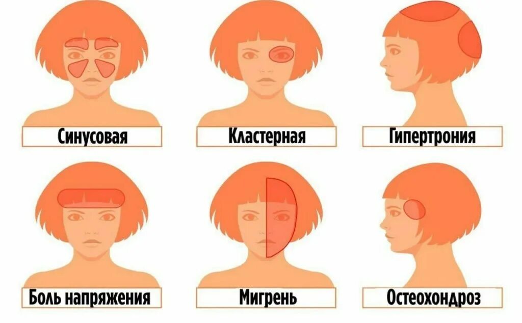 Гайд по головным болям. Гайды на все случаи жизни формы груди