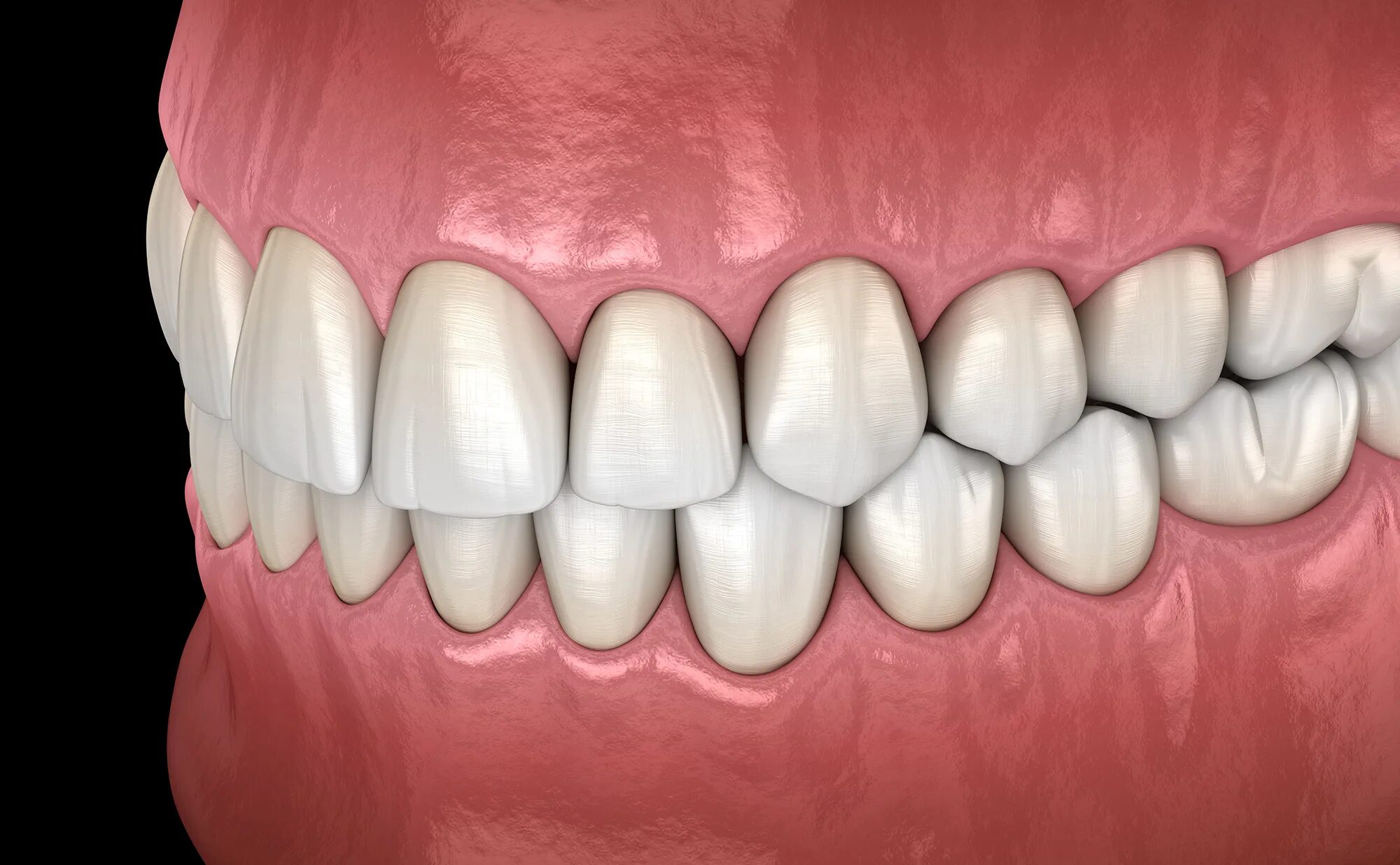 красивые ровные зубы в профиль. красивые зубы. каппы инвизилайн. улыбка с зубами в профиль. красивая улыбка.