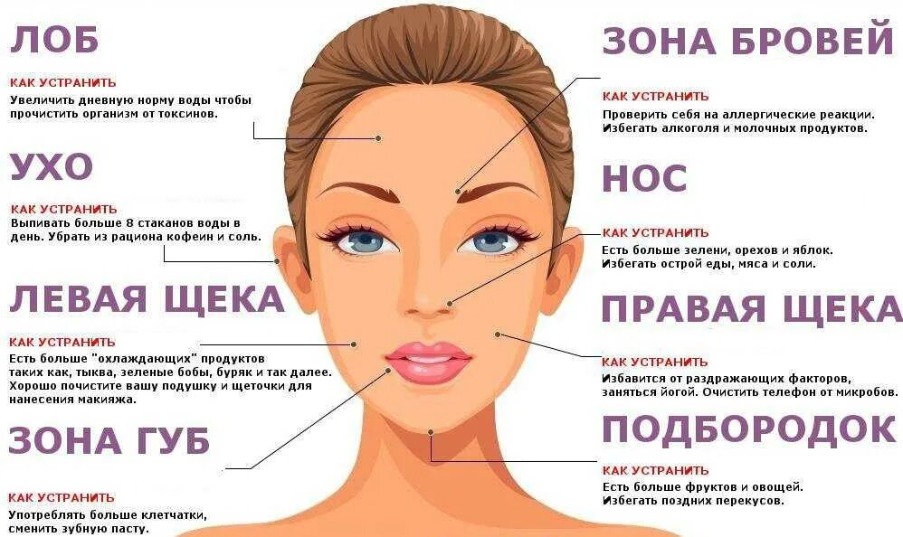 Что делать чтобы не было прыщей