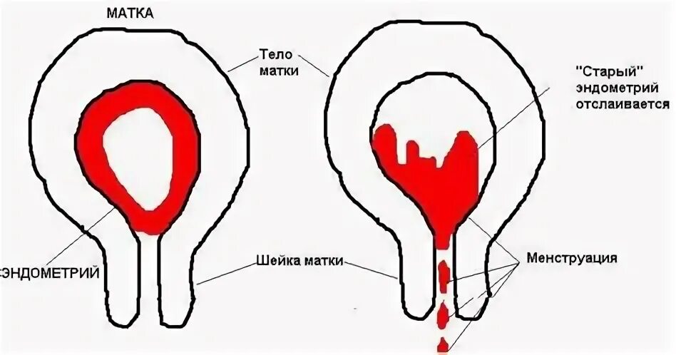 Обильные месячные причины после 40