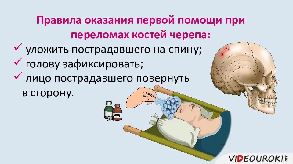 При переломе черепа необходимо. Правила оказания первой помощи при переломе костей черепа. при переломе костей черепа пострадавшему. оказание первой помощи при переломе кости черепа. перелом костей свода черепа первая помощь.