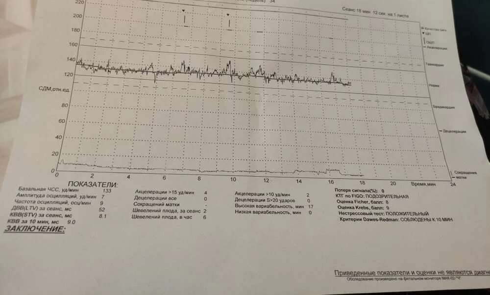 КТГ плода. КТГ 2. КТГ при беременности. КТГ коэффициент технической готовности. Нормы ктг 33 недели