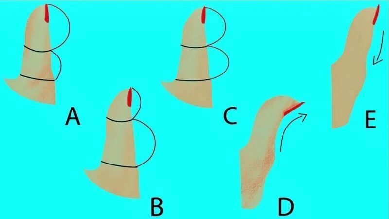 Характер по форме пальцев. Изогнутый большой палец. Большой палец изгиб