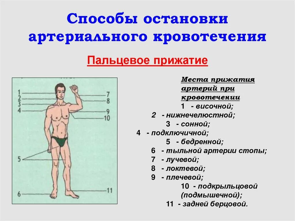 Способы остановки кровотечения пальцевое прижатие артерии