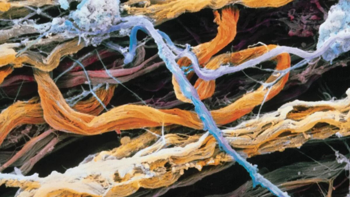 Синтез коллагена в коже. Эластин и коллаген. Структура кожи collagen elastin. Эластин гистология. Волокна коллагена в коже.