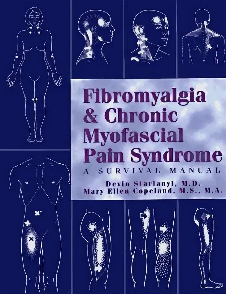Myofascial physiotherapy device user manual инструкция. Фибромиалгия упражнения. myofascial pain syndrome fibromyalgia. myofascial physiotherapy device user manual инструкция на русском.