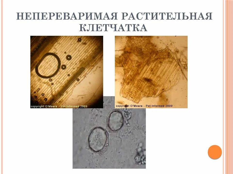 Растительная клетчатка в кале что значит. Микроскопия кала растительная клетчатка непереваримая. Микроскопия кала растительная клетчатка. Микроскопия кала переваримая клетчатка. Растительная клетчатка переваримая в Кале.