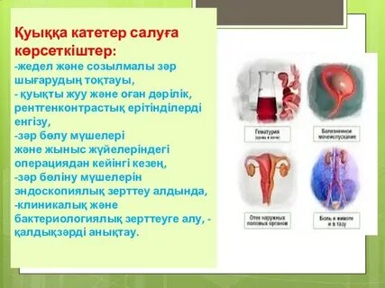 Жоғарғы жағындағы порно позиция