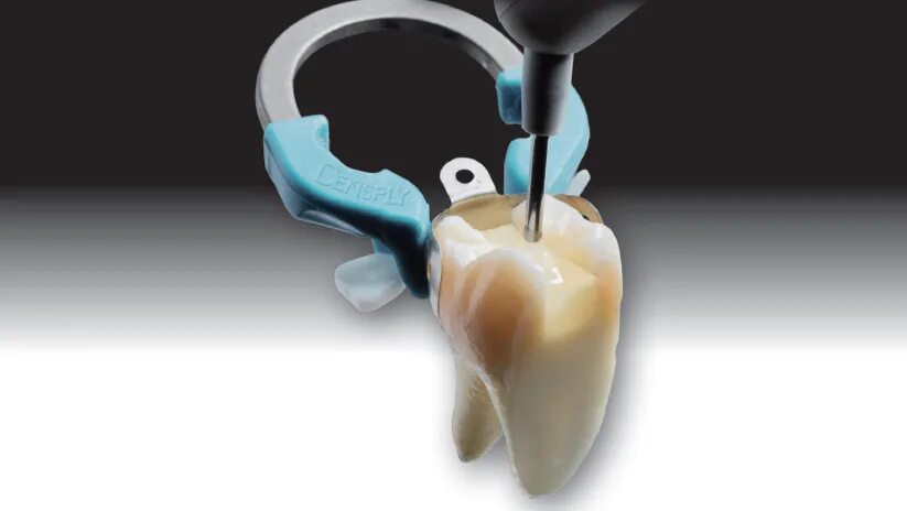 Виды контактных пунктов в стоматологии. Контактный пункт восстановление контактного пункта. Контактный пункт восстановление контактного пункта. Контактный пункт способы восстановления. Контактный пункт способы восстановления.