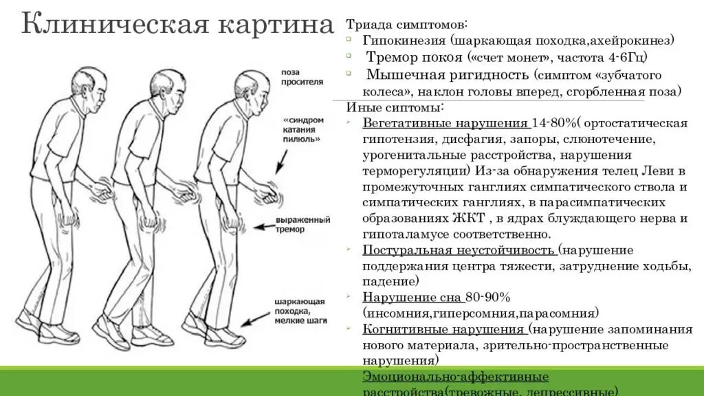 Слабость после ходьбы. Дифференциальный диагноз при болезни Паркинсона. Клинические проявления болезни Паркинсона. Клинические проявления синдрома паркинсонизма. Диф диагностика болезни Паркинсона и паркинсонизма.