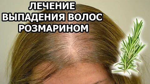 Розмарин от выпадения