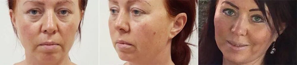 рустем каримов пластический хирург